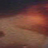 The Wilson Bifocal - Image 13